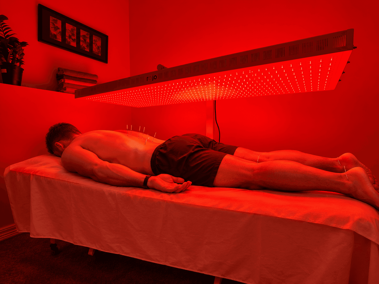Acupuncture + Rejuvenation Room Package